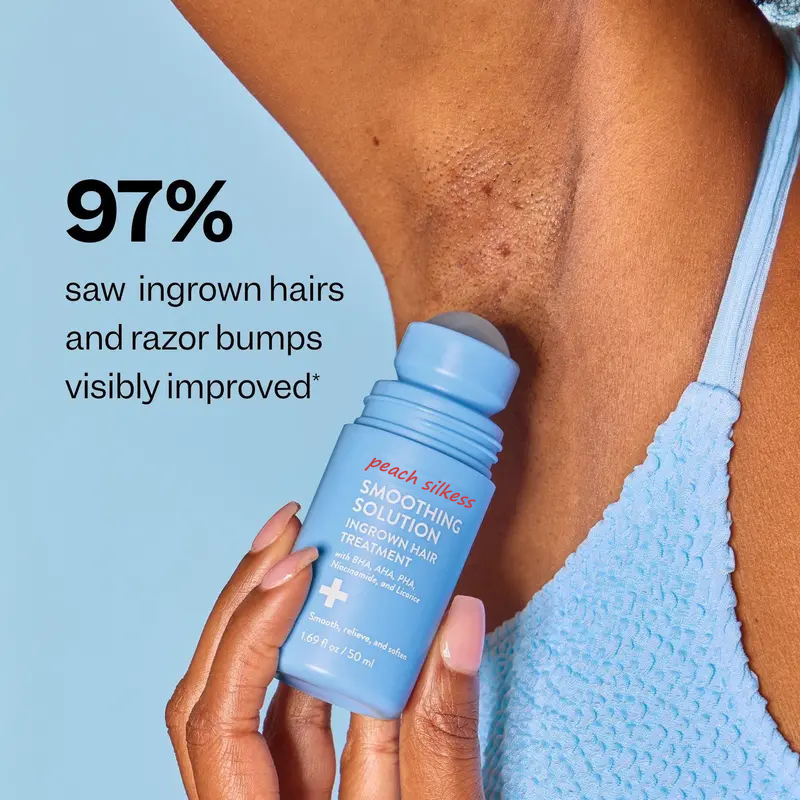 🏆LAST DAY SALE 64% OFF⏰{Peach Silkess Official} Smoothing Solution Ingrown Hair Treatment